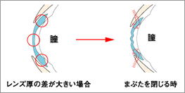 メダリストⅡ