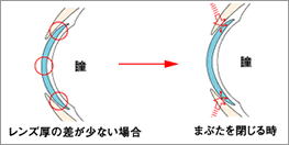 メダリストⅡ